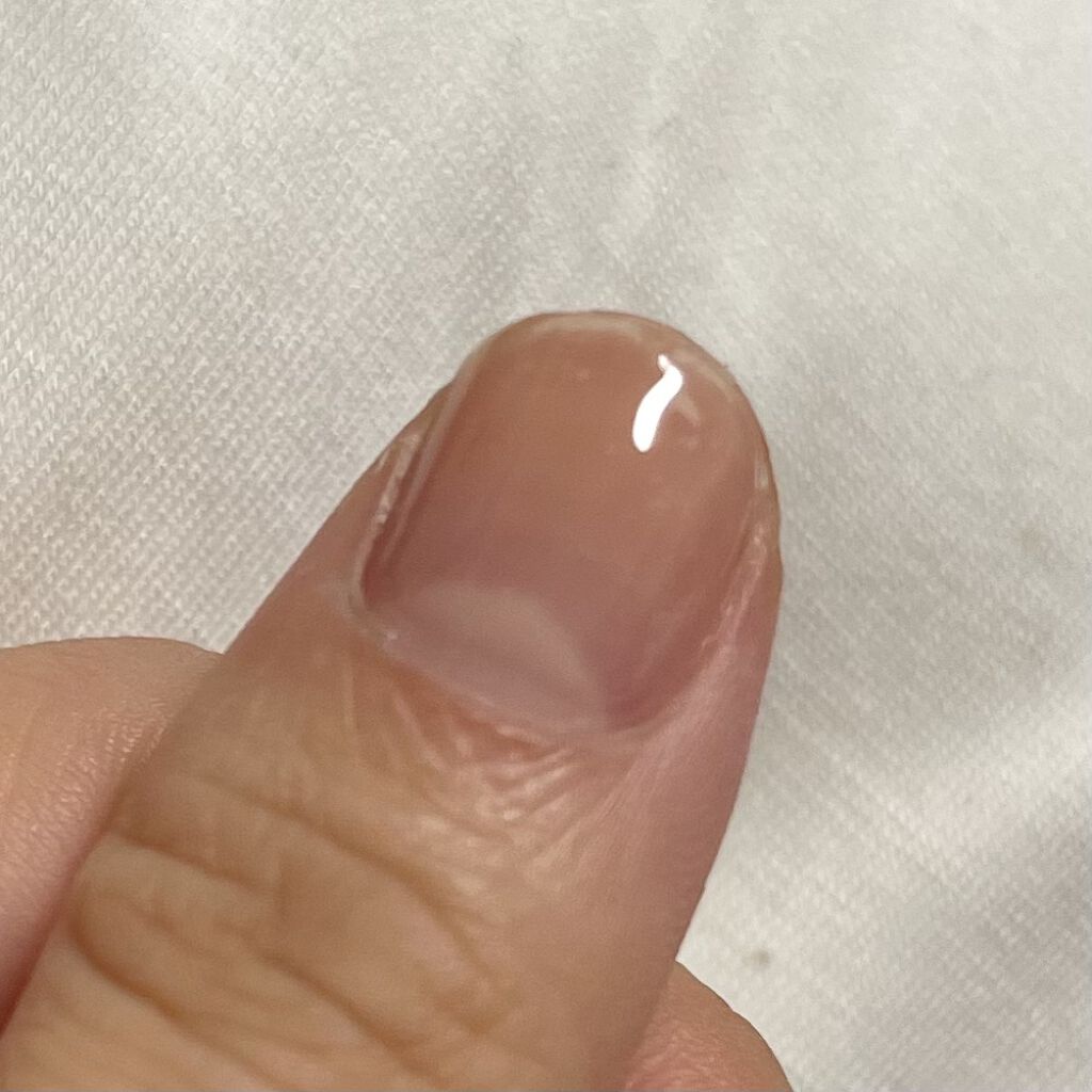 スプリットリペアN/ネイルネイル/ネイルオイル・トリートメントを使ったクチコミ（3枚目）