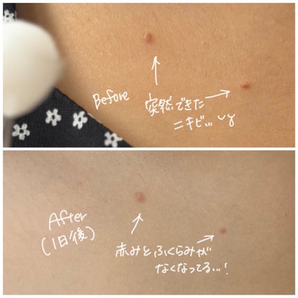 RXザ・AHA2 BHA2 ブラミッシュトリートメントセラムコットン/COSRX/美容液を使ったクチコミ(4枚目)