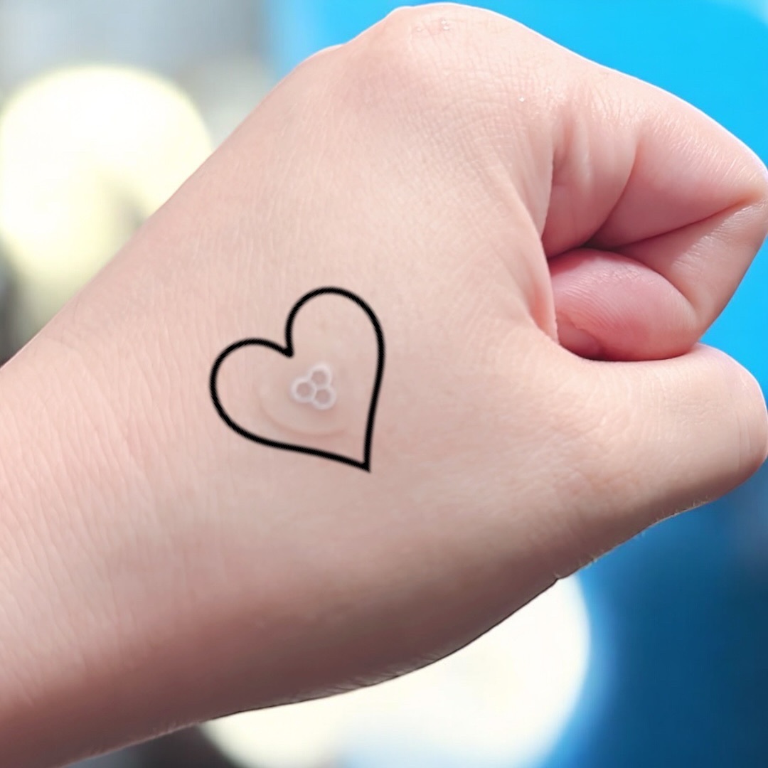 ACマグネシウムパッチ　ミニ/スノーツープラス/にきびパッチを使ったクチコミ（3枚目）