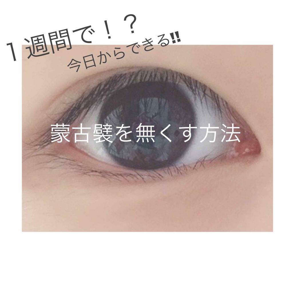 アイトーク/アイトーク/二重まぶた用アイテムを使ったクチコミ（1枚目）