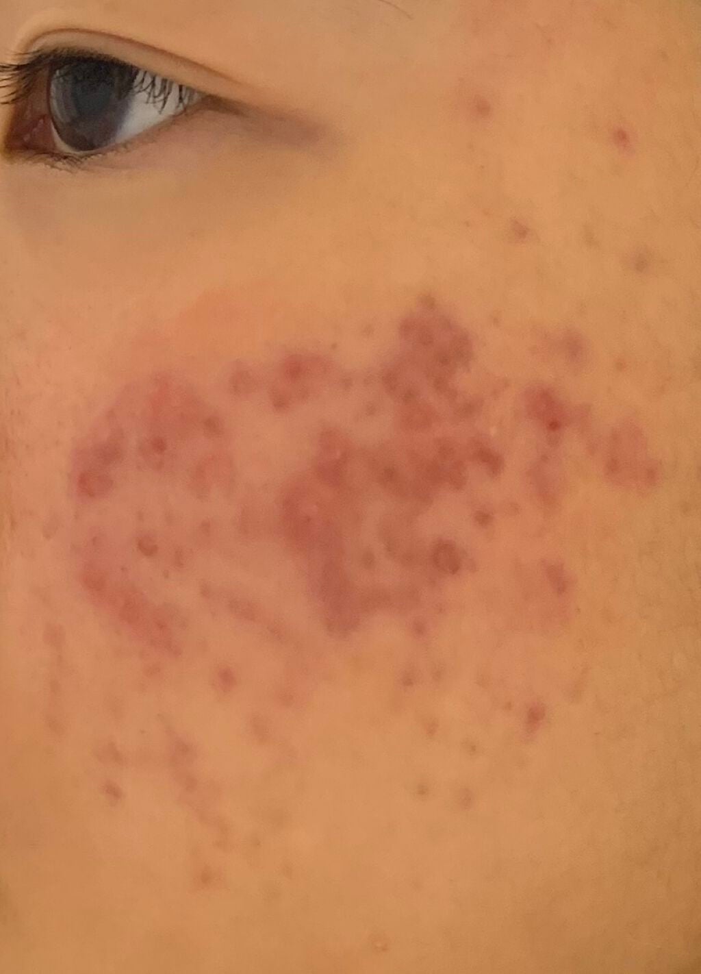 化粧水・敏感肌用・高保湿タイプ/無印良品/化粧水を使ったクチコミ(3枚目)