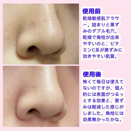 セラムショット N/PHOEBE BEAUTY UP/美容液を使ったクチコミ(3枚目)