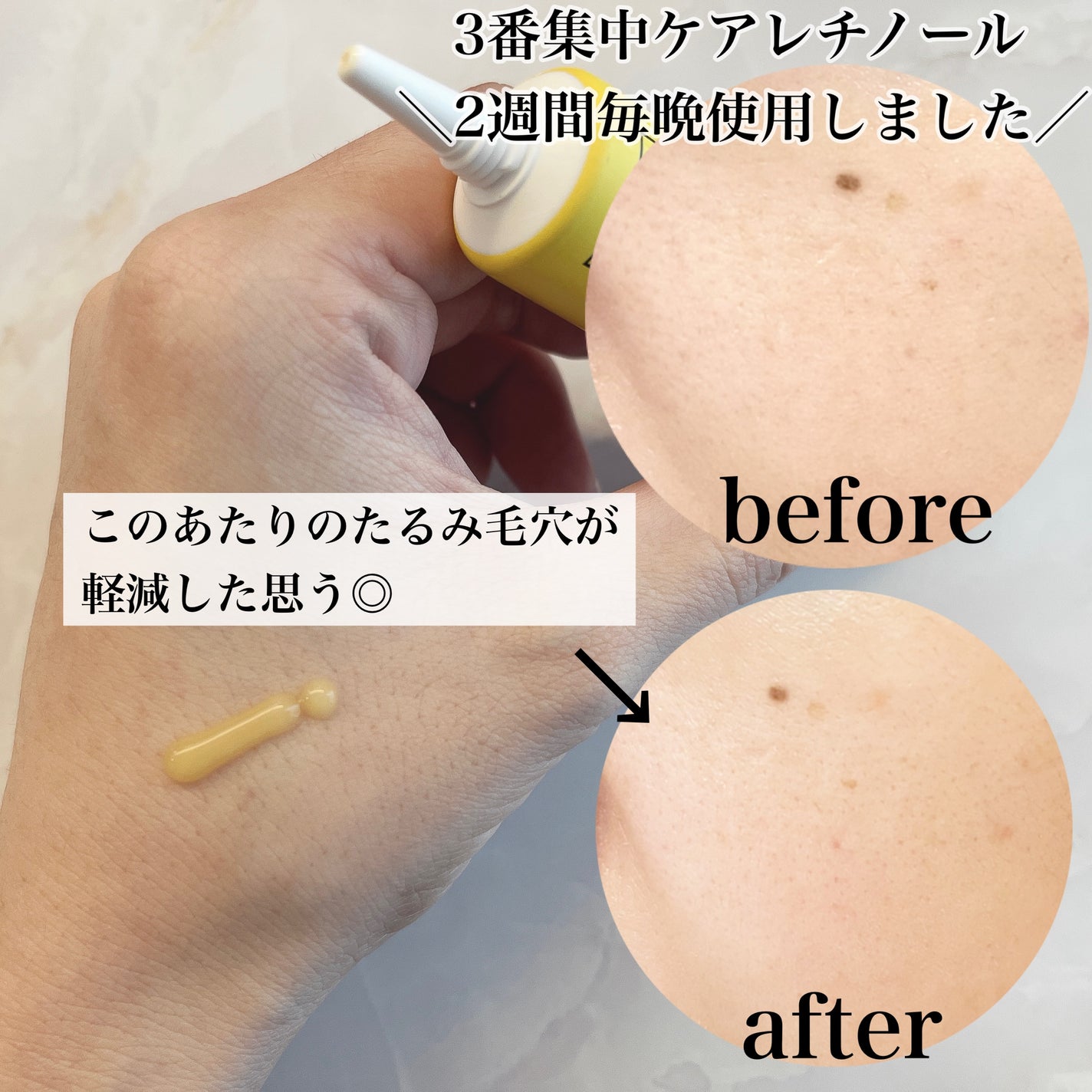 3番 集中ケアレチノール美容液/numbuzin/美容液を使ったクチコミ(2枚目)