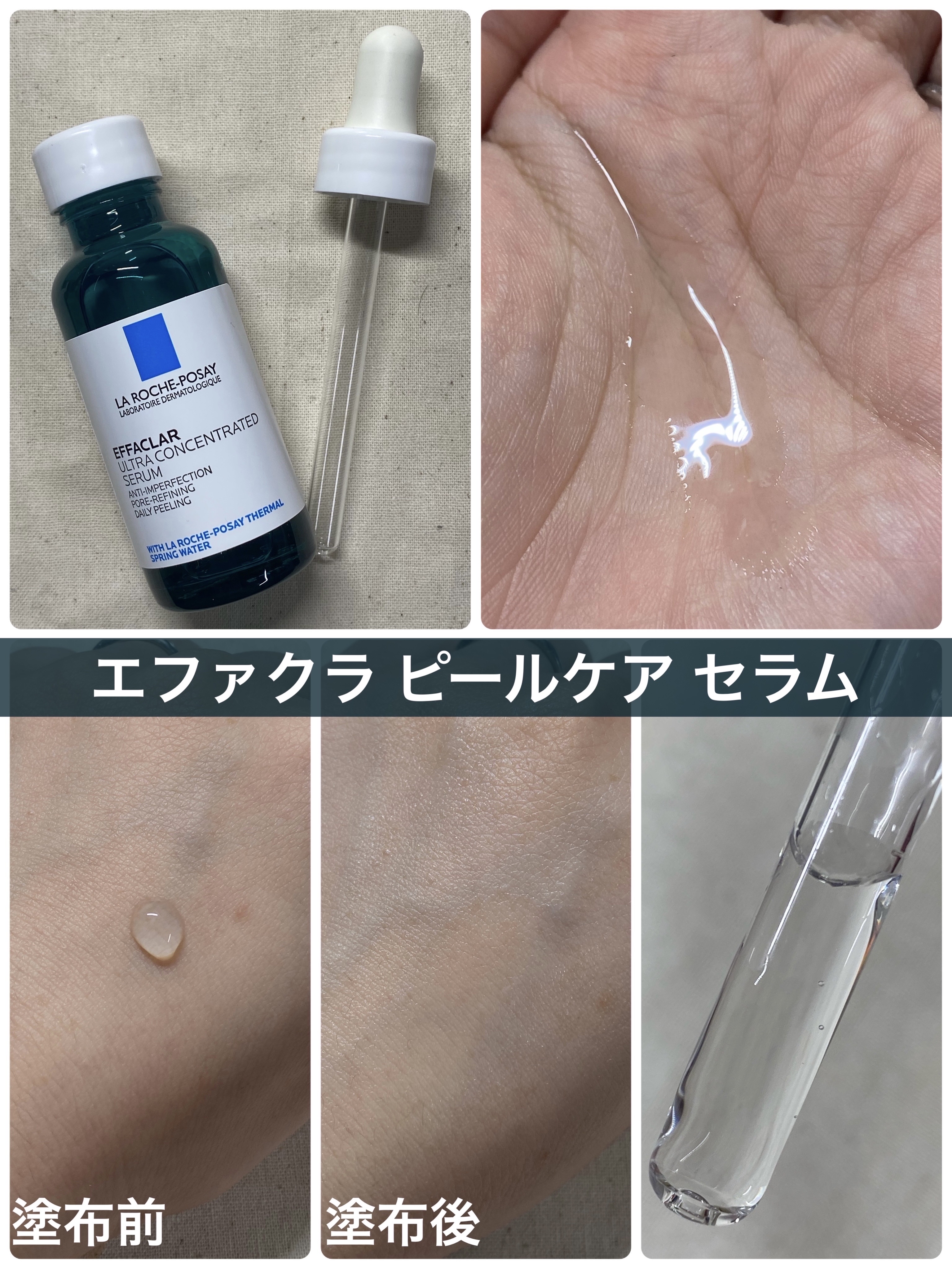 エファクラ ピールケア セラム/ラ ロッシュ ポゼ/美容液を使ったクチコミ（2枚目）