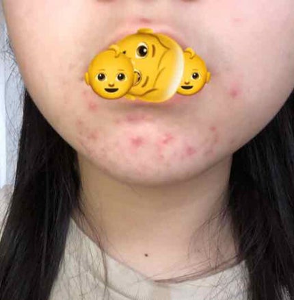 敏感肌用薬用美白美容液/無印良品/美容液を使ったクチコミ(3枚目)