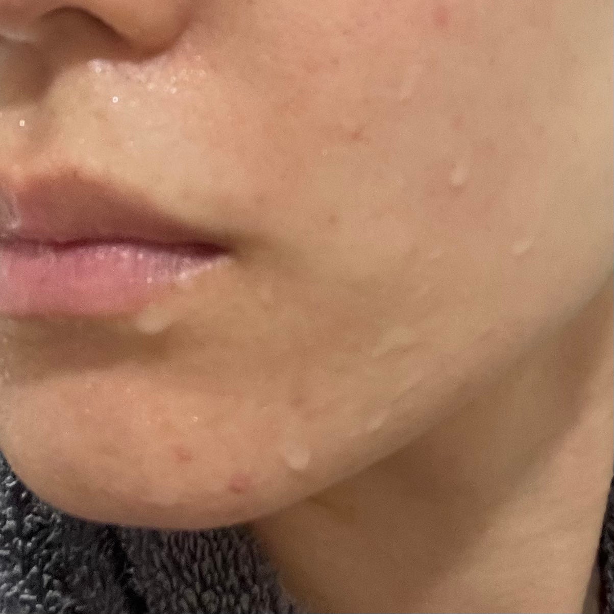 フェイシャルブースティングスパ/Makeon/美顔器・マッサージを使ったクチコミ(6枚目)