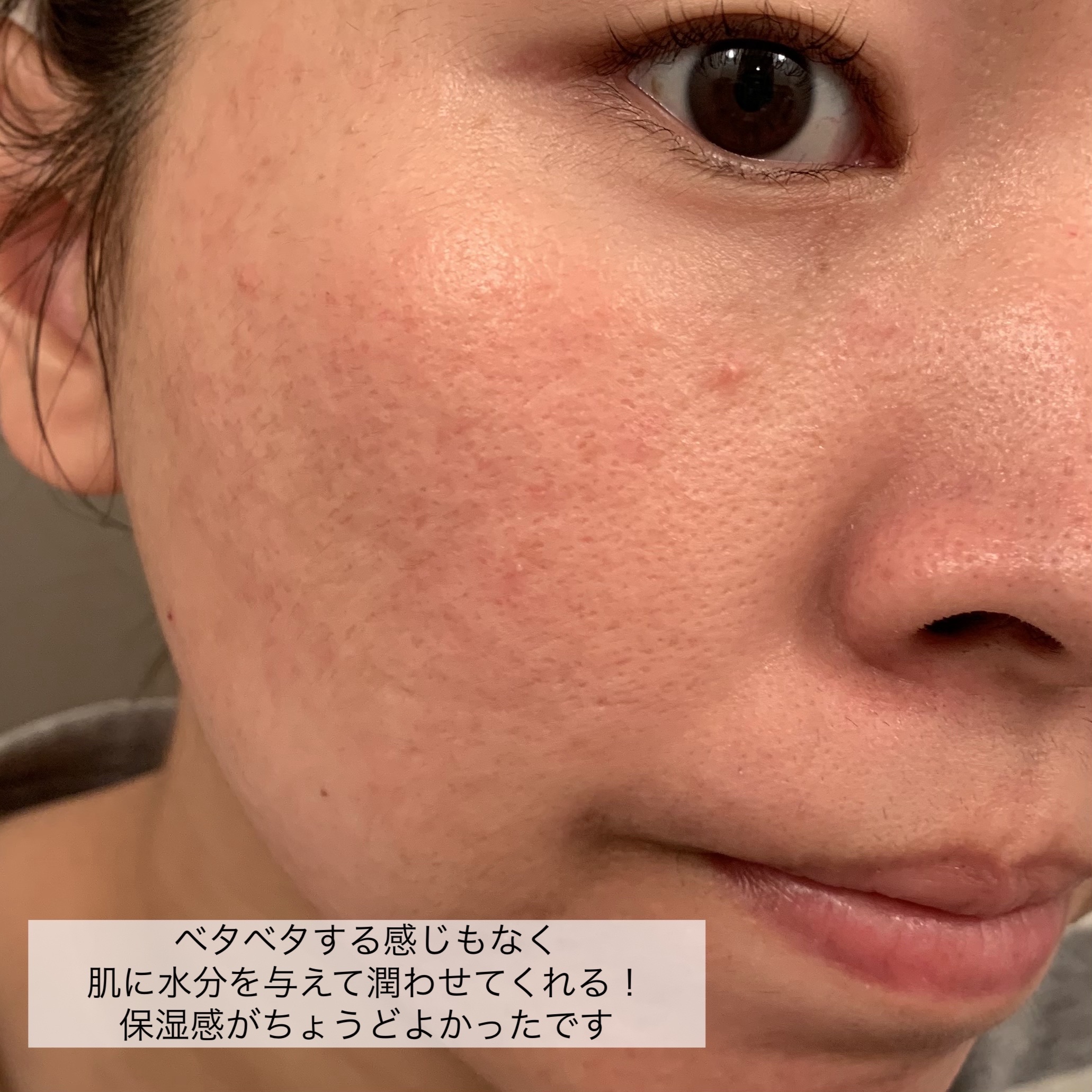 京都ルルルン（お茶の花の香り）/ルルルン/シートマスク・パックを使ったクチコミ（3枚目）