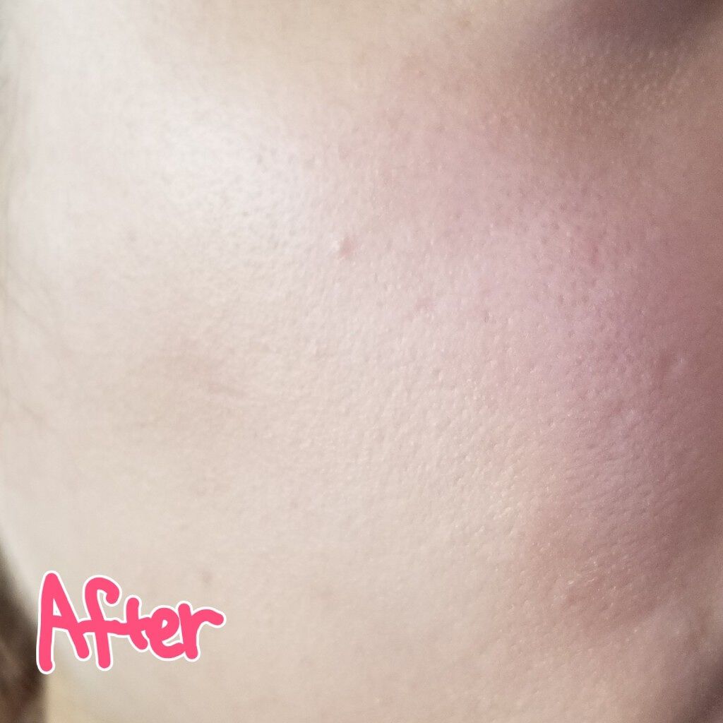 (旧)アンリミテッド ラスティング フルイド/shu uemura/リキッドファンデーションを使ったクチコミ(3枚目)