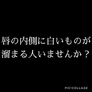 私は今まで、リップをぬったあとに少したつと
唇の内側に白いものが溜まっててずっと悩んでいました。



まわりの友達も「なにそれ？」「そんなのなったことないよ？」って
感じなので私だけなのかなって不安で