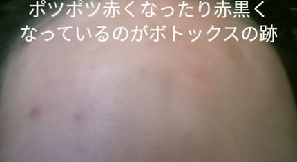 を使ったクチコミ(1枚目)