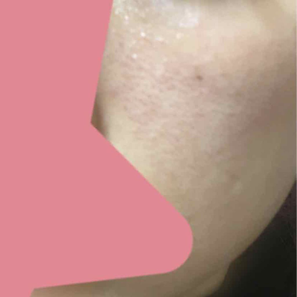 ハトムギ化粧水(ナチュリエ スキンコンディショナー R )/ナチュリエ/化粧水を使ったクチコミ（2枚目）