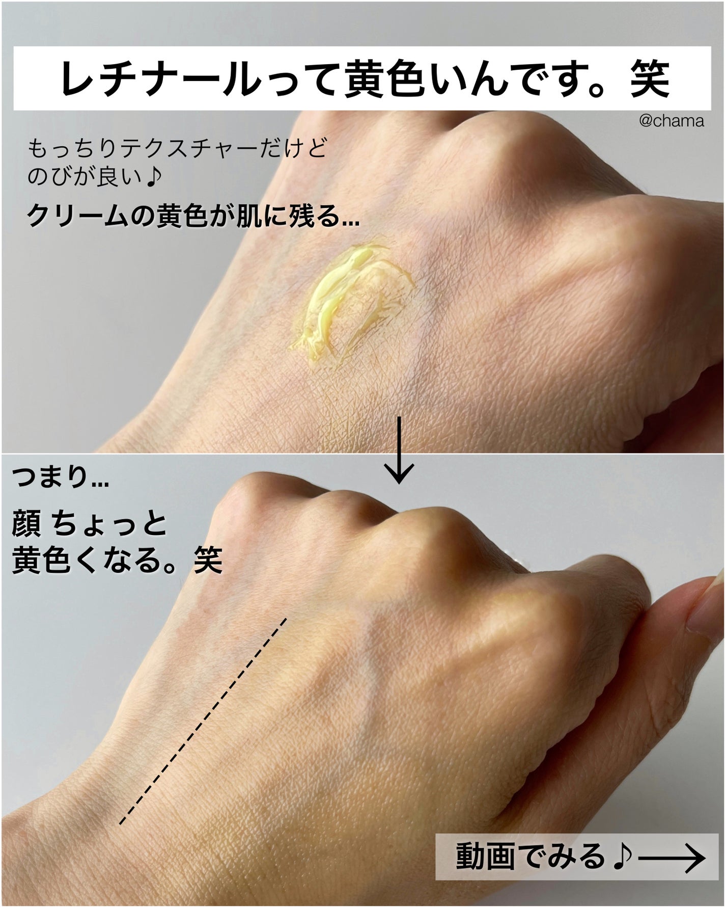 VITALIFT A forte/Dr.Different/フェイスクリームを使ったクチコミ(5枚目)