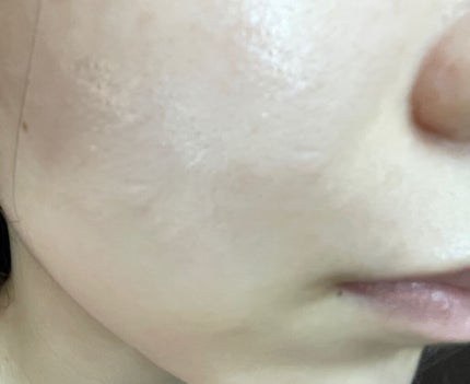 N.M.FアクアアンプルマスクJEX/MEDIHEAL/シートマスク・パックを使ったクチコミ(3枚目)