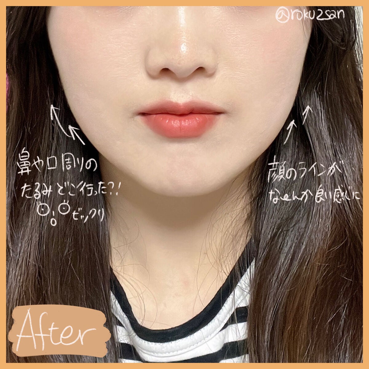 RENAð/FB匷åäž on LIPS ãðçŸå®¹ã¯ãªããã¯æ¥èšð广ãããã«ç®ã«èŠããŠã³ã£ããðŠããããª..ãïŒ3æç®ïŒ