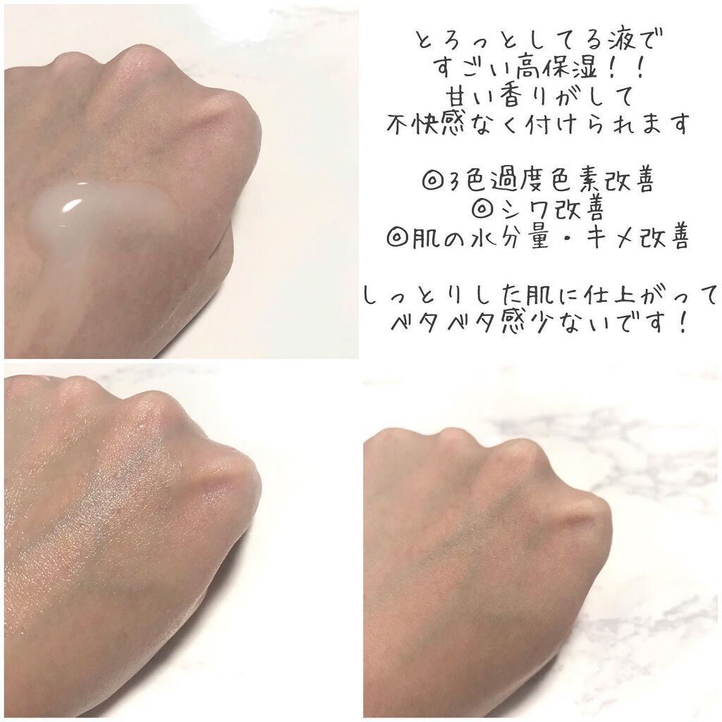 プロバイオティクマスクシート/イルドン製薬/シートマスク・パックを使ったクチコミ(4枚目)