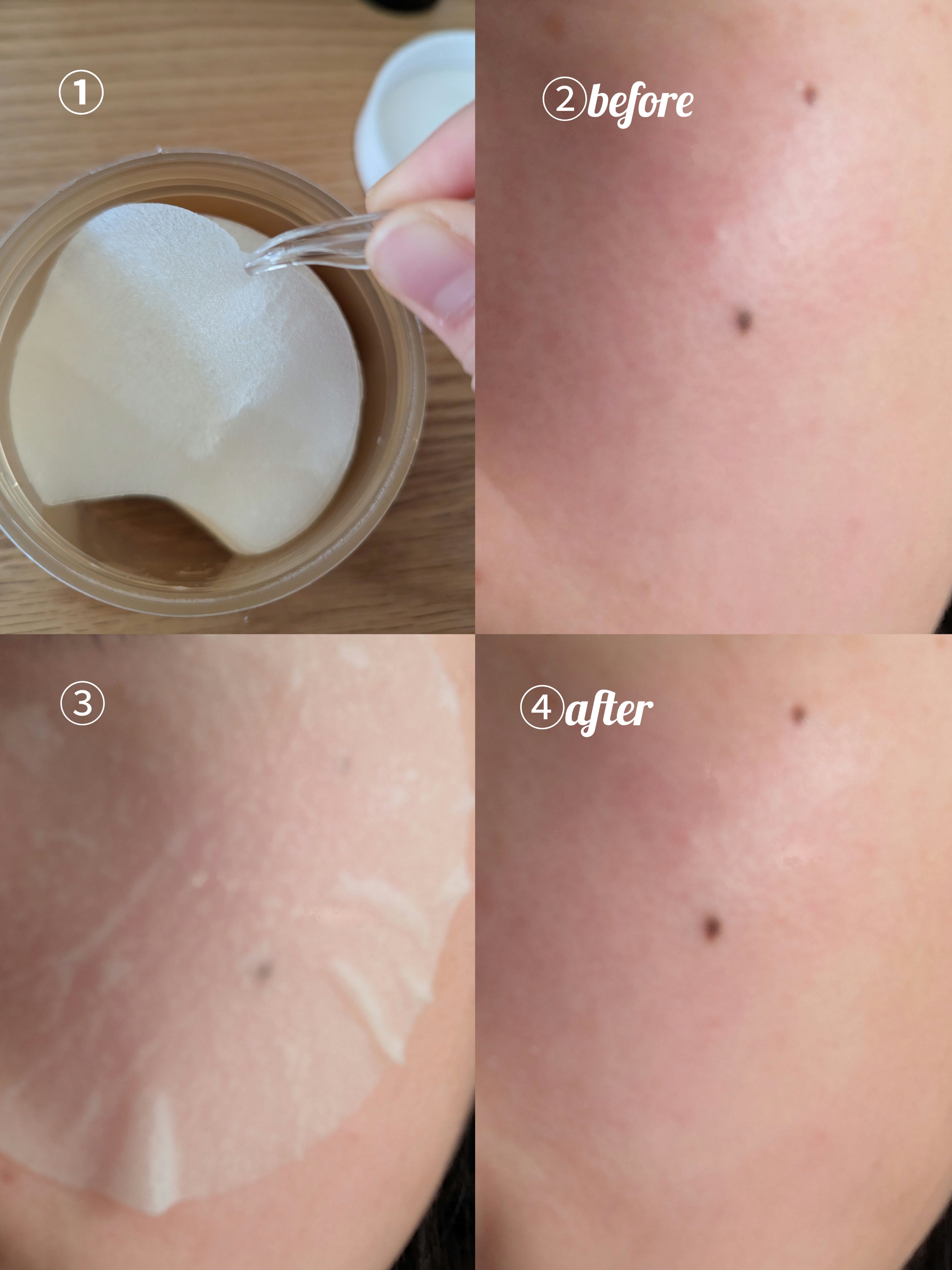 センテラ クイックカーミングパッド/SKIN1004/トナーパッドを使ったクチコミ（2枚目）