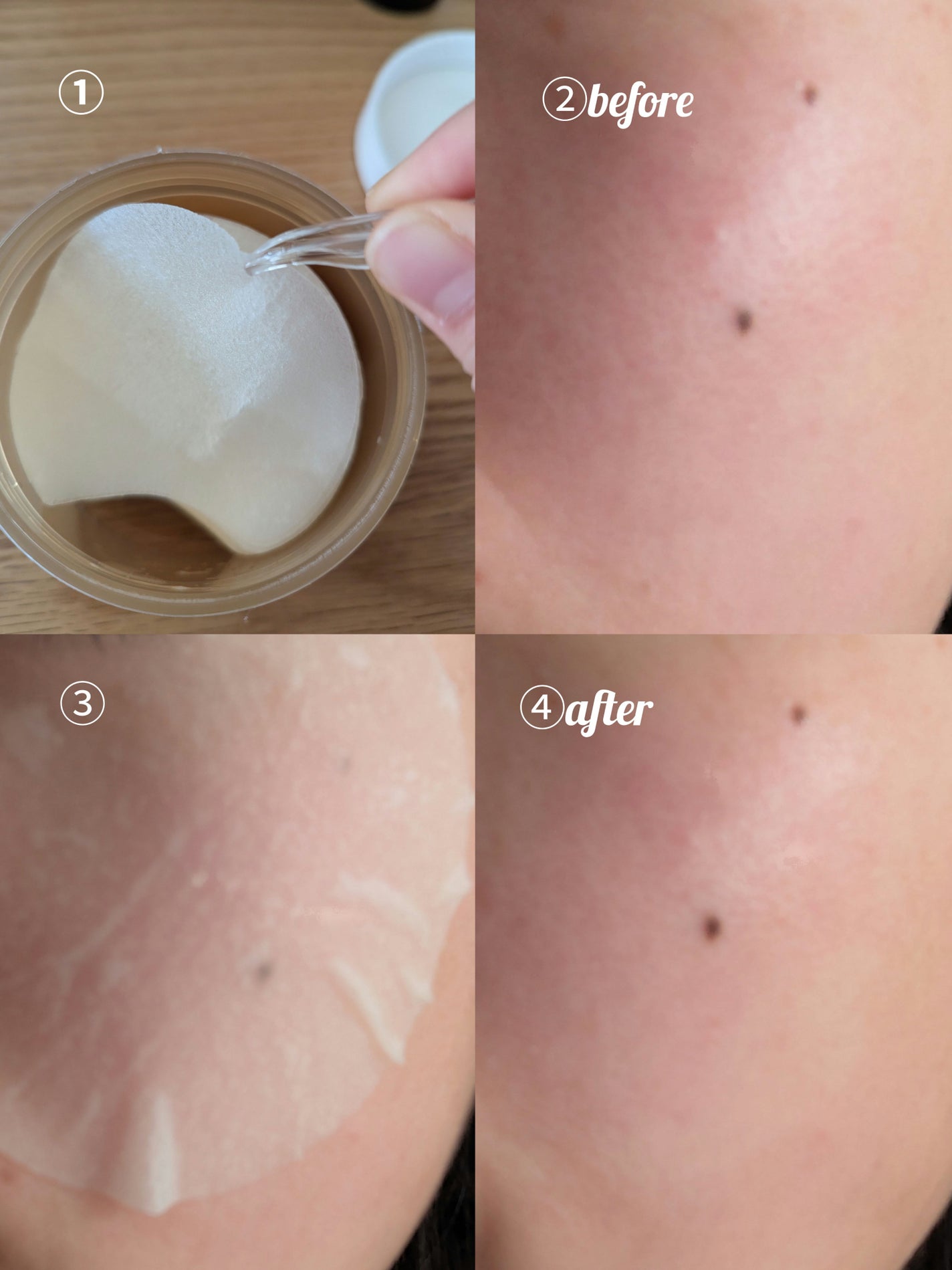 センテラ クイックカーミングパッド/SKIN1004/トナーパッドを使ったクチコミ(2枚目)