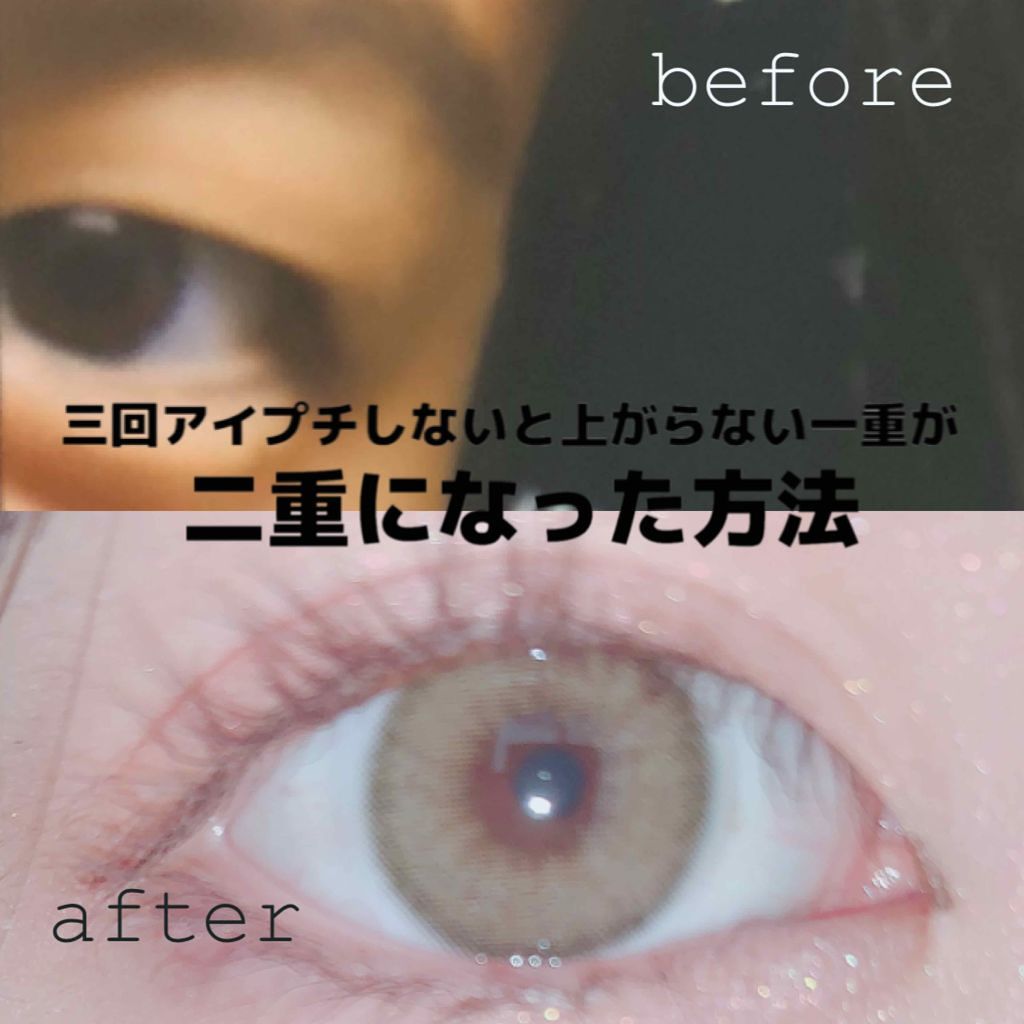 アイビューティー フィクサー WP/アストレア ヴィルゴ/二重まぶた用アイテムを使ったクチコミ（1枚目）