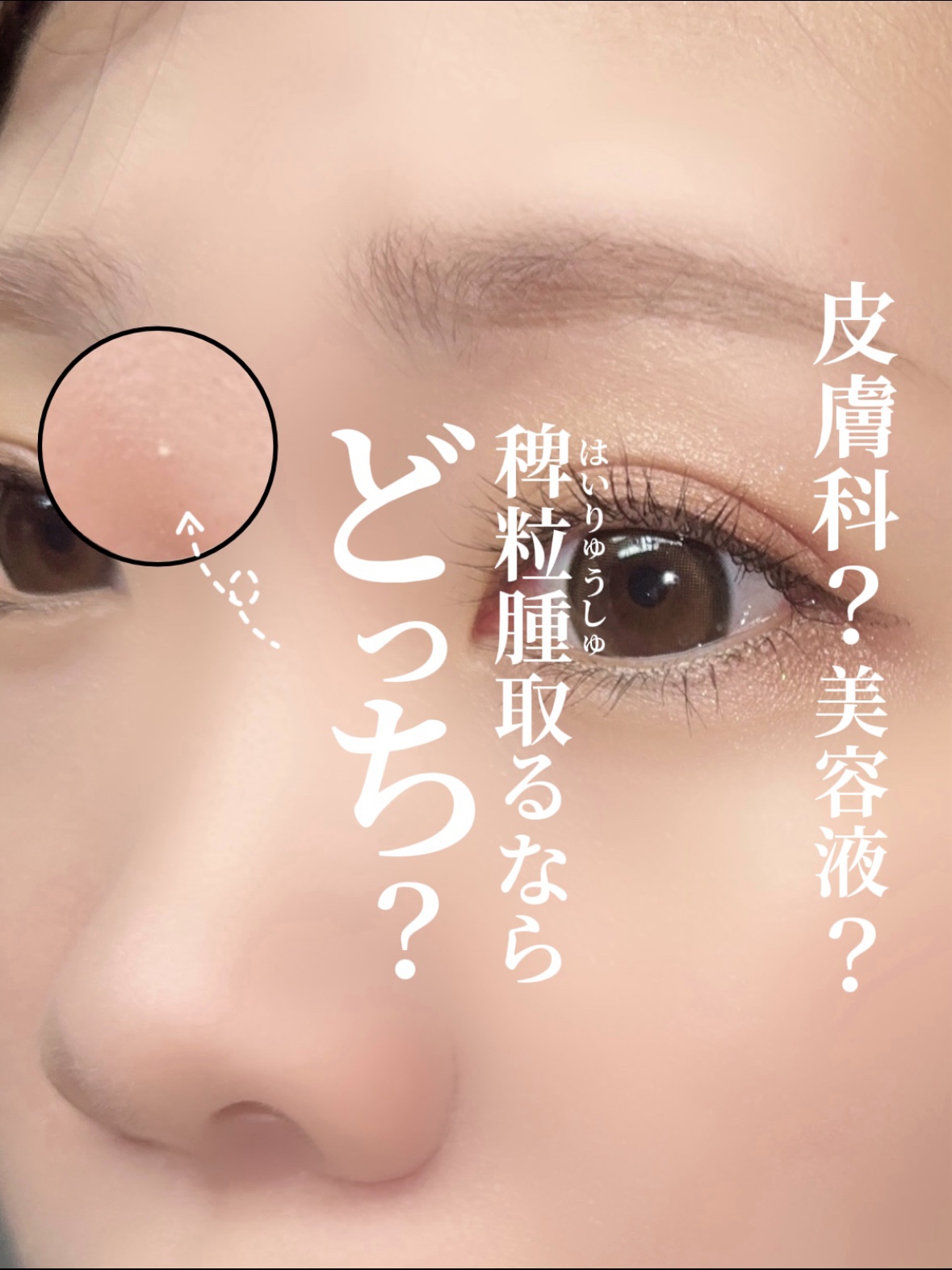 オーガニック ハトムギエキス (ヨクイニン)/KISO/その他を使ったクチコミ（1枚目）