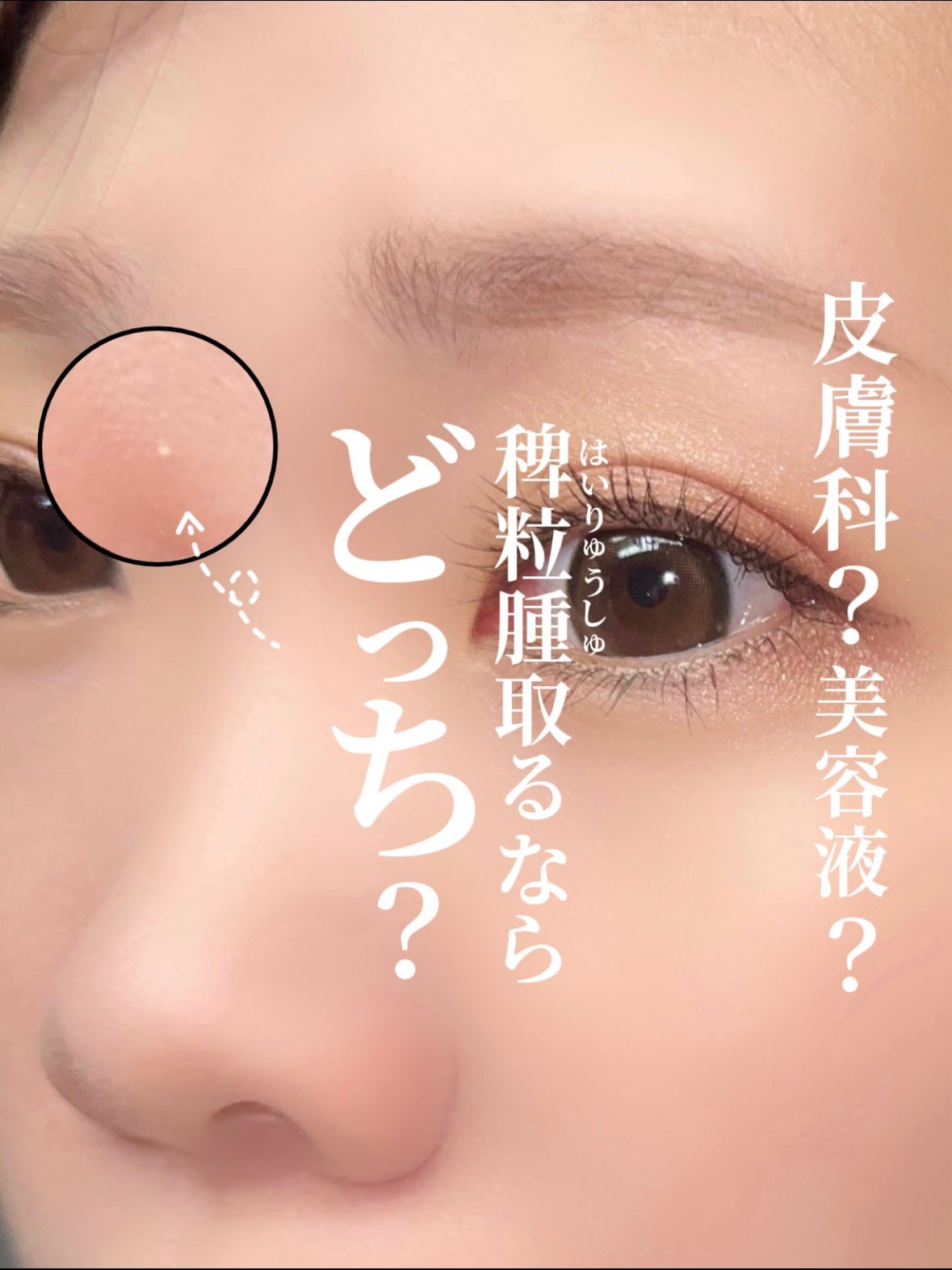 オーガニック ハトムギエキス (ヨクイニン)/KISO/その他を使ったクチコミ(1枚目)