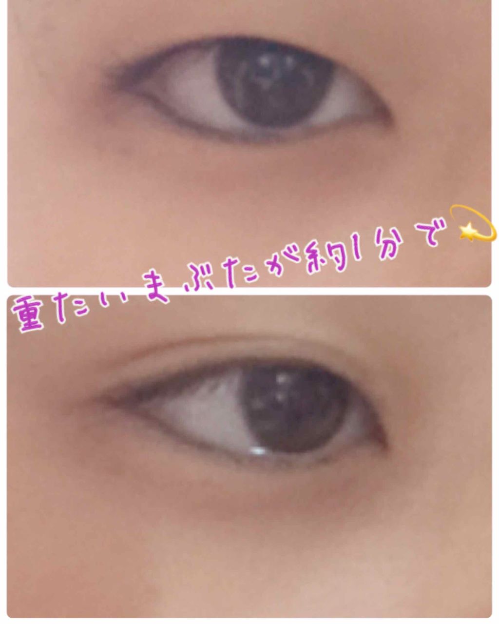 ハイブリッドフィルム/アイトーク/二重まぶた用アイテムを使ったクチコミ(3枚目)