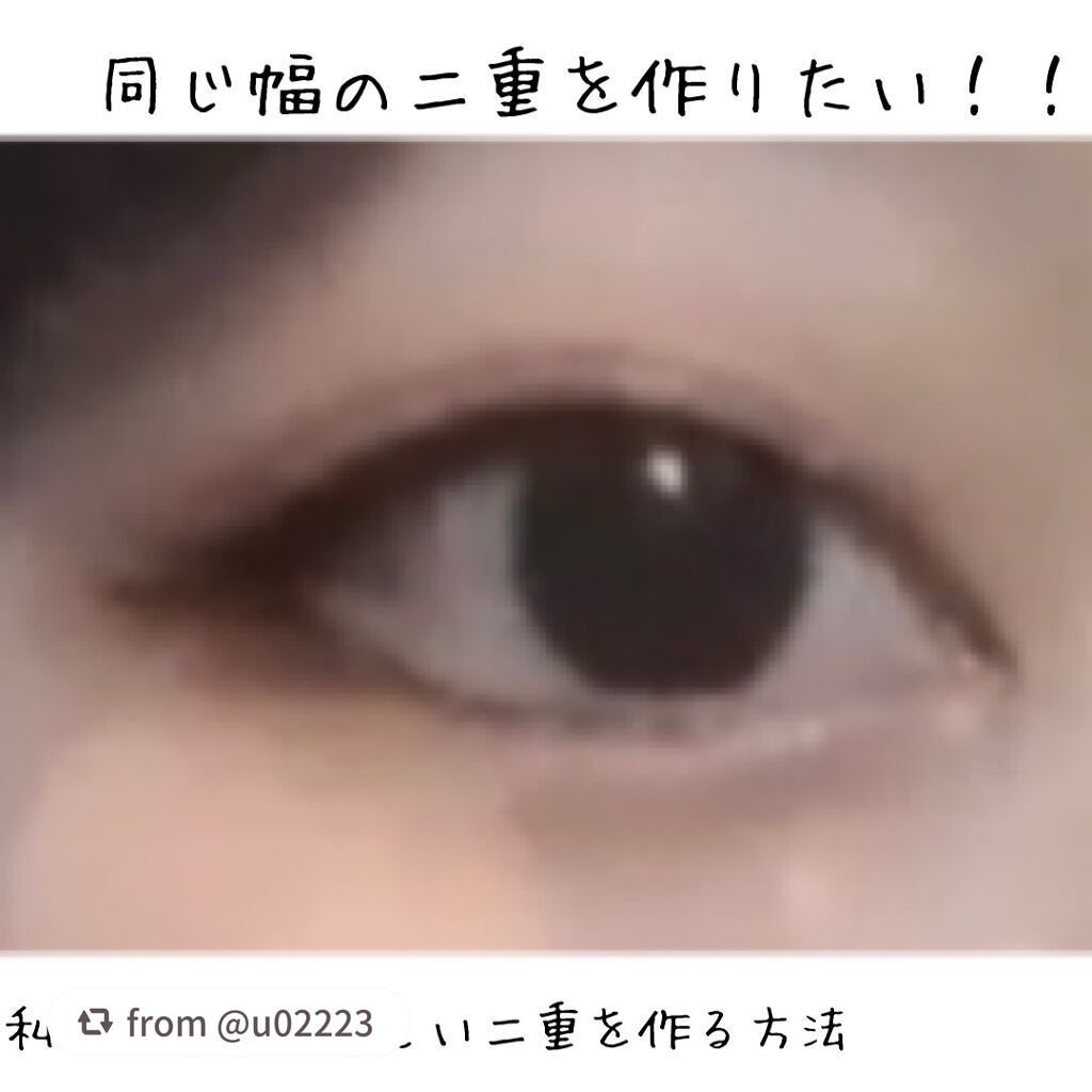アイトーク/アイトーク/二重まぶた用アイテムを使ったクチコミ(1枚目)
