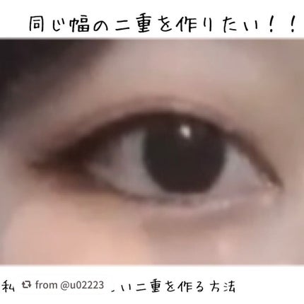 アイトーク/アイトーク/二重まぶた用アイテムを使ったクチコミ(1枚目)