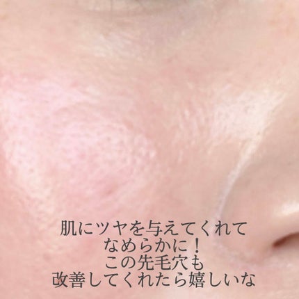 シカレチA エッセンス0.1/VT/美容液を使ったクチコミ(3枚目)