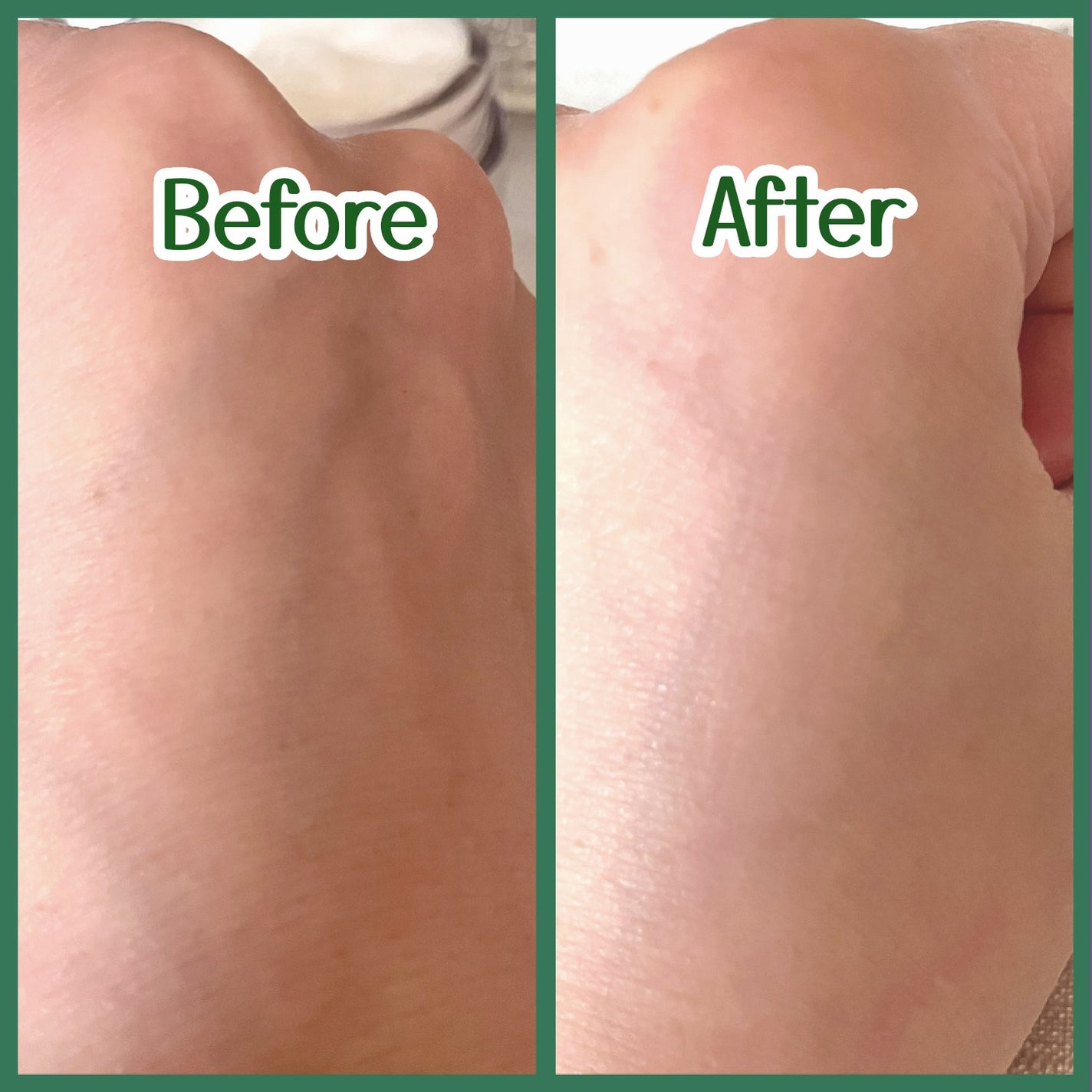 レッドブレミッシュ クリアモイスチャークリーム/Dr.G/フェイスクリームを使ったクチコミ(6枚目)