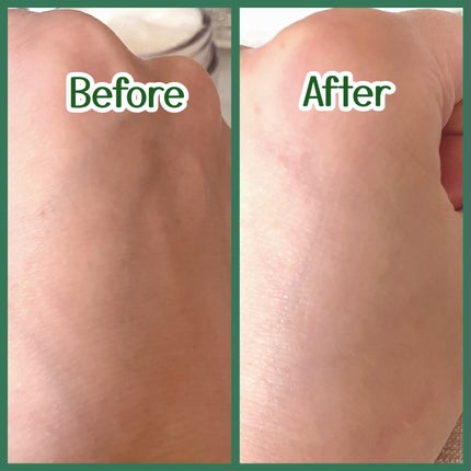 レッドブレミッシュ クリアモイスチャークリーム/Dr.G/フェイスクリームを使ったクチコミ(6枚目)