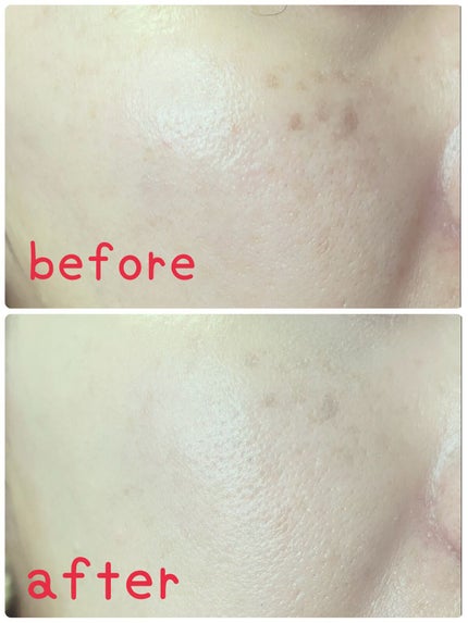 メタフィットヴィーガンクッション/AMUSE/クッションファンデーションを使ったクチコミ(4枚目)