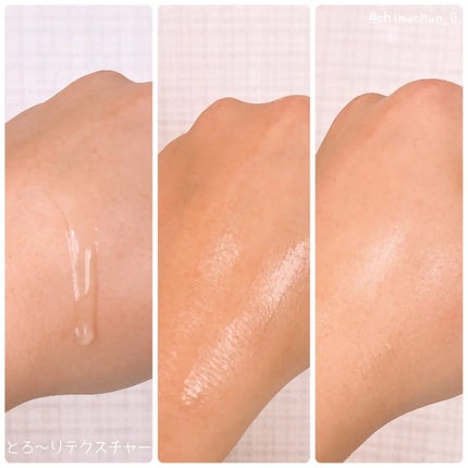 TXトーニングエッセンス1000SHOT/VT/美容液を使ったクチコミ(2枚目)