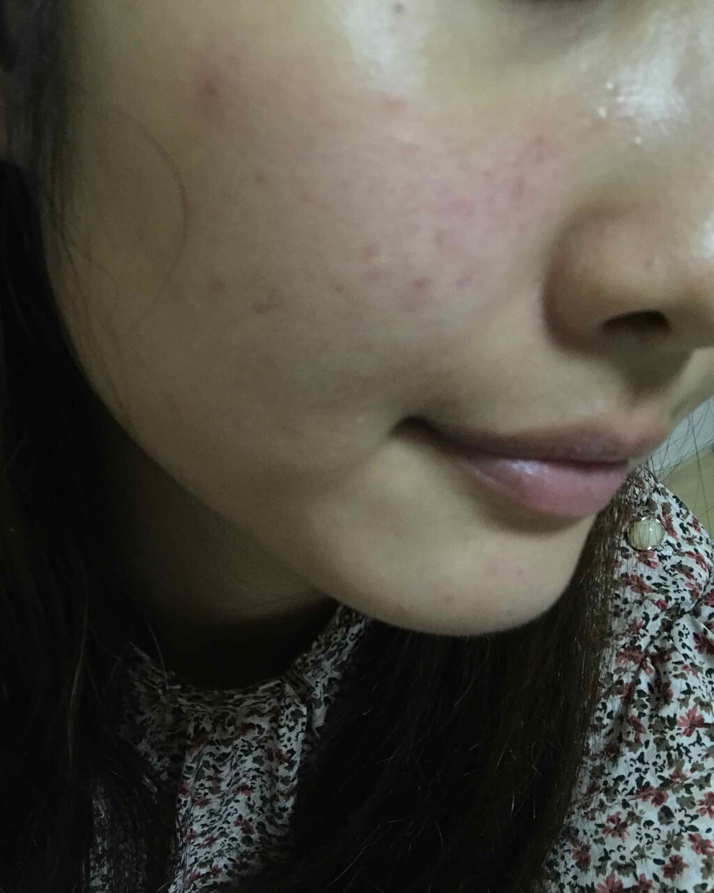 薬用美白美容液/なめらか本舗/美容液を使ったクチコミ（1枚目）