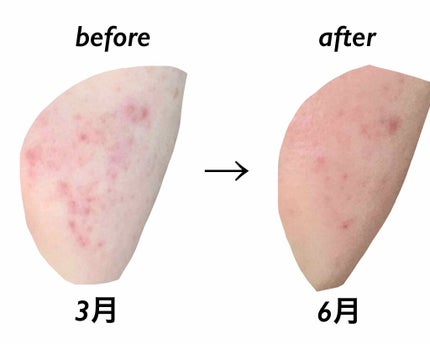 を使ったクチコミ(3枚目)