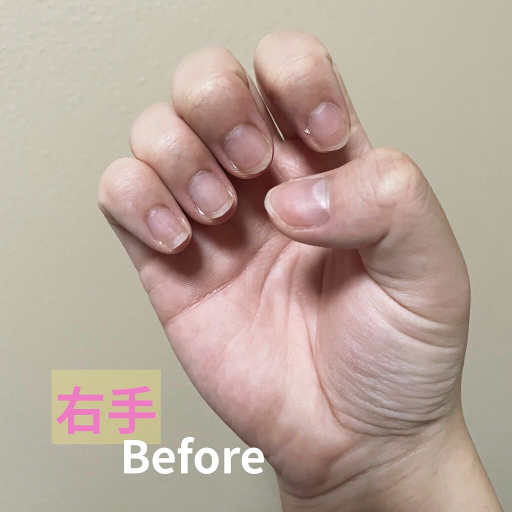 エテュセ クイックケアコート/ettusais/ネイルオイル・トリートメントを使ったクチコミ（2枚目）