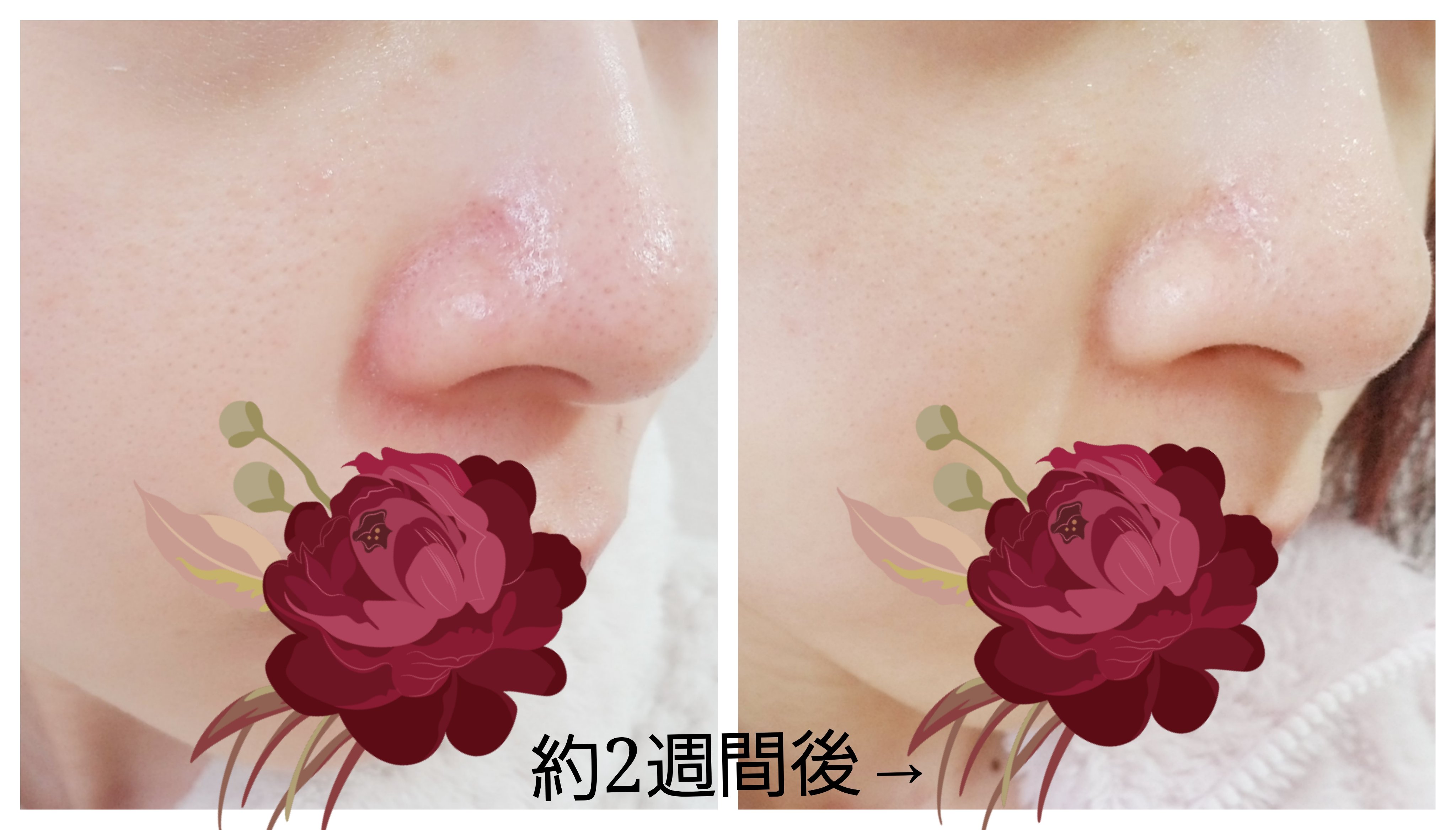 CICA デイリースージングマスク/VT/シートマスク・パックを使ったクチコミ（2枚目）