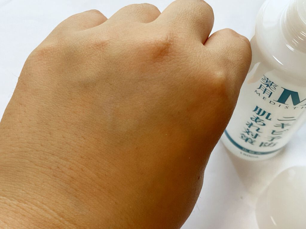 MEDISTHE 薬用NI-KIBI 化粧水のクチコミ「ニキビ・肌荒れ対策に！
大人のニキビケア！男女兼用薬用アクネローション☆
『メディステ アクネ.....」（3枚目）