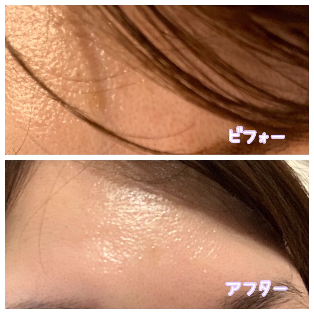 スノーセル/メディタミン/美容サプリメントを使ったクチコミ(3枚目)