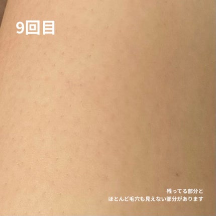 FASIZ607C IPL光脱毛器/FASIZ/家庭用脱毛器を使ったクチコミ(9枚目)