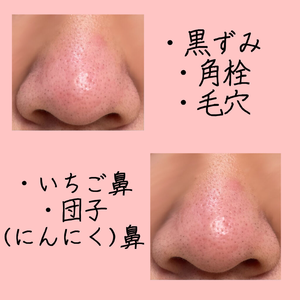 ジョンソン ベビーオイル 無香料/ジョンソンベビー/ボディオイルを使ったクチコミ（2枚目）