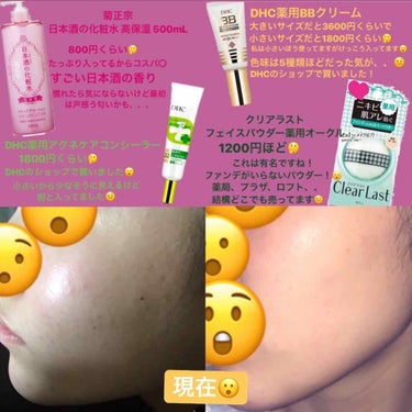 きなこもち on LIPS 「🤭どうしようもないなかった肌荒れをメイクしながら治した話🤭こん..」（3枚目）