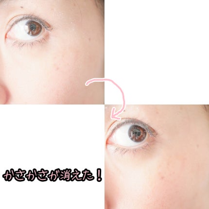 ストレッチマークオイル/EARTHCHILD/美容液を使ったクチコミ(9枚目)