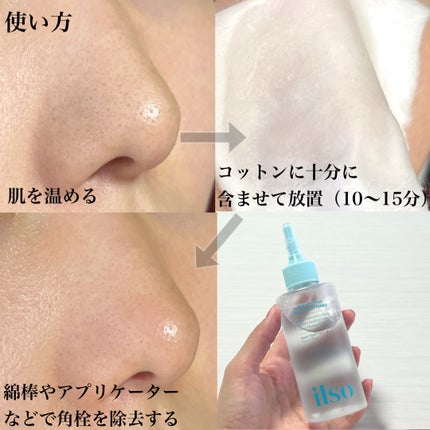 ILSO スーパーメルティング セバムソフトナー/ilso/化粧水を使ったクチコミ(6枚目)