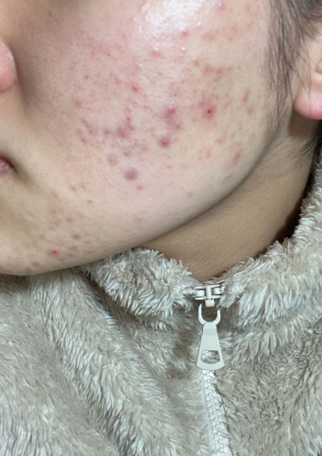 化粧水・敏感肌用・高保湿タイプ/無印良品/化粧水を使ったクチコミ（3枚目）