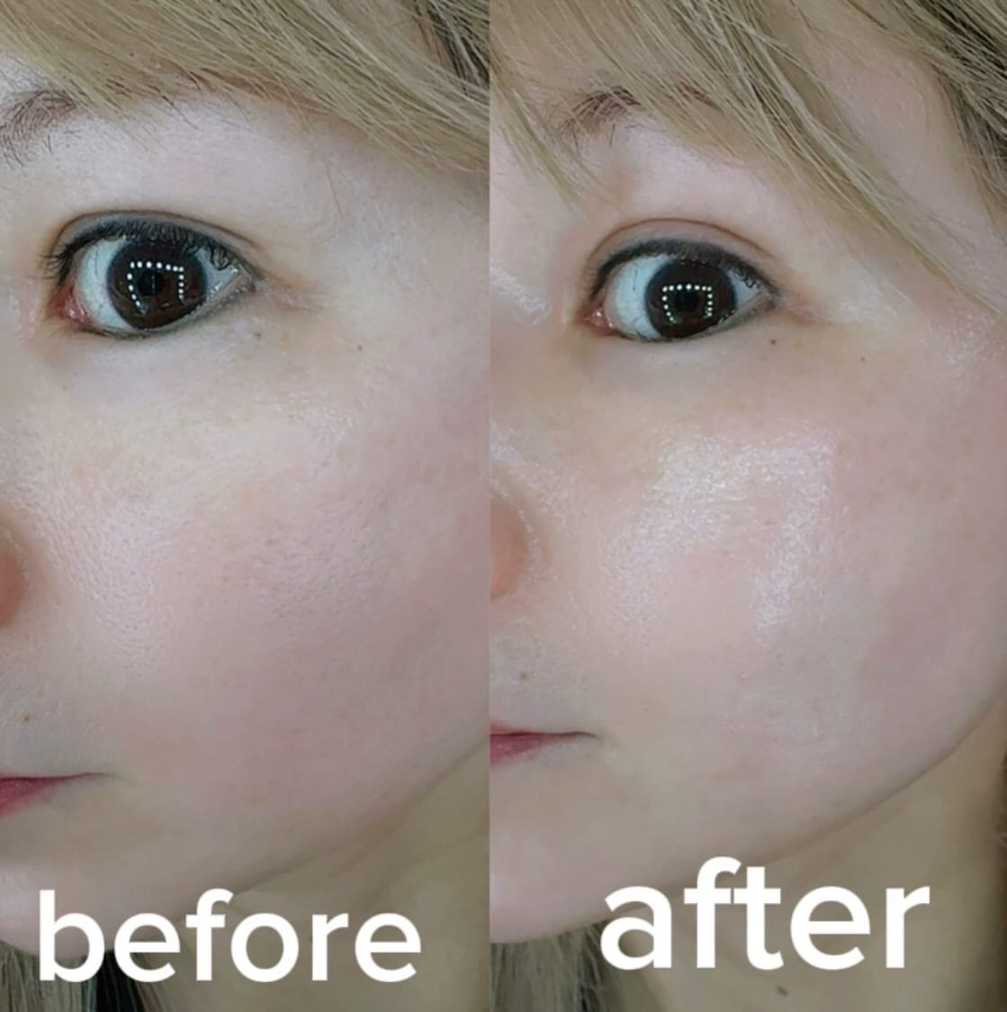 オールグリーントックスソリューションクリーム/MEDIPICKME/フェイスクリームを使ったクチコミ(5枚目)