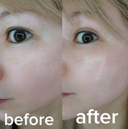 オールグリーントックスソリューションクリーム/MEDIPICKME/フェイスクリームを使ったクチコミ(5枚目)