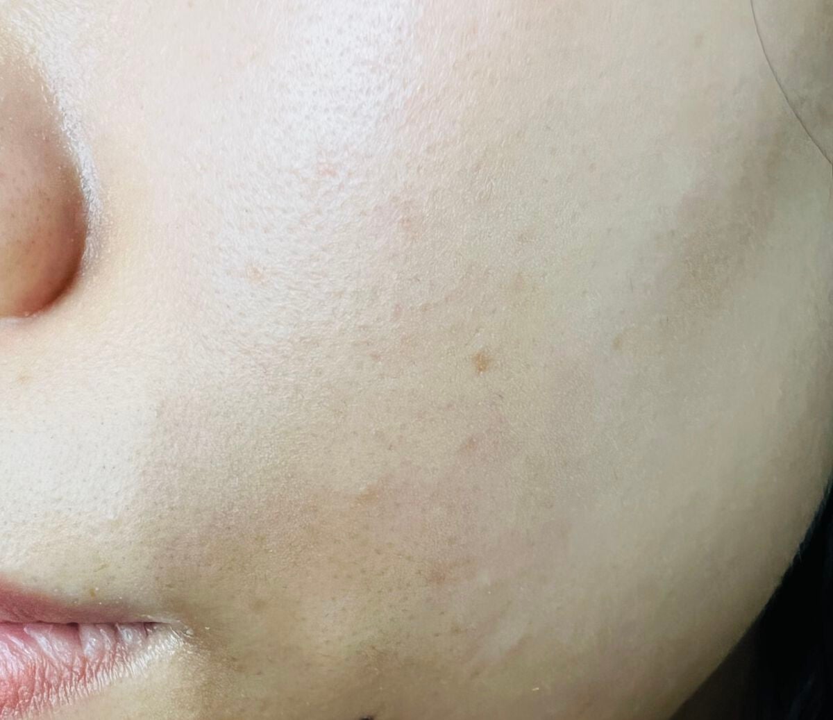 薬用アクネクリーム/NIKI PITA/フェイスクリームを使ったクチコミ(5枚目)