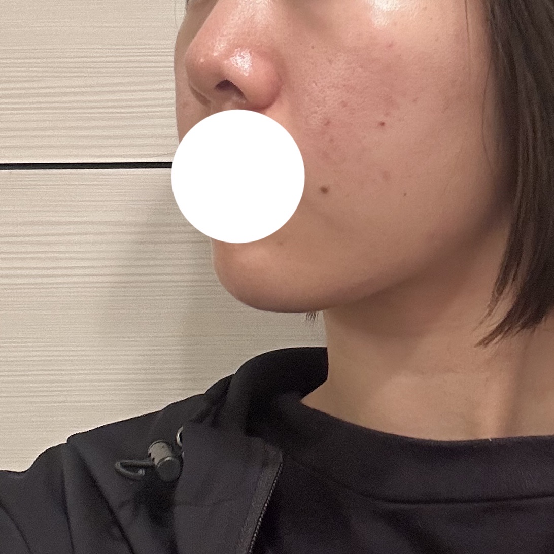 ボタニック クレンジング オイル 150ml/shu uemura/オイルクレンジングを使ったクチコミ（2枚目）