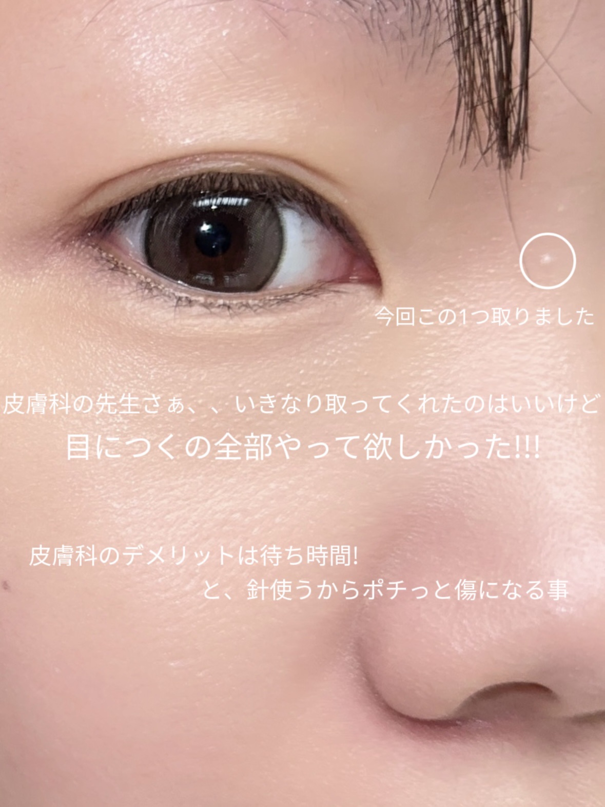 オーガニック ハトムギエキス (ヨクイニン)/KISO/その他を使ったクチコミ（3枚目）