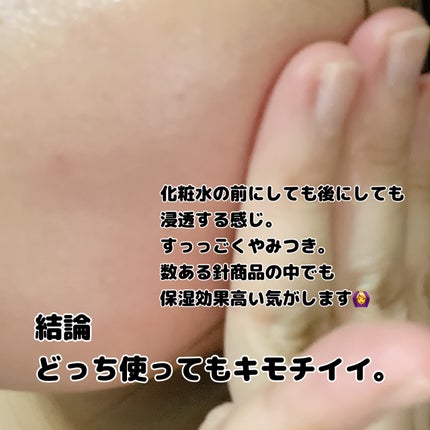 ゼロ1DAYエクソソームショット2000/MEDICUBE/美容液を使ったクチコミ(3枚目)